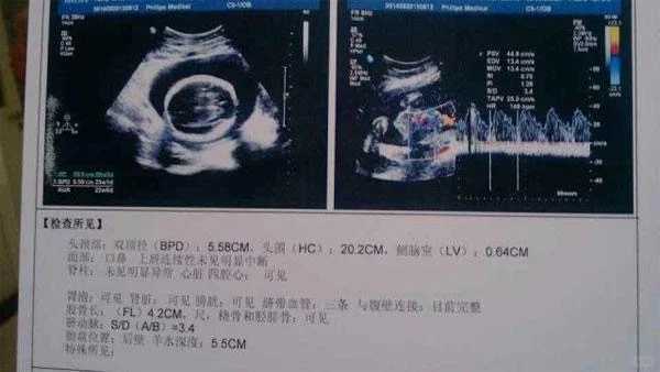 借卵费用分期方案：减轻经济压力的实用策略